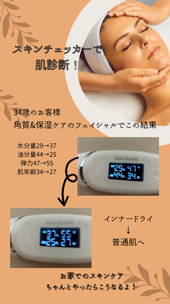 ブログ